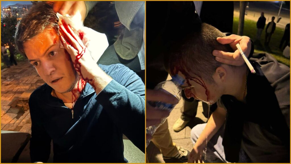 შსს: ჩხუბში მონაწილეობდა ნარმანიასთან ერთად მყოფი 10-ზე მეტი ახალგაზრდა, მეორე მხრივ 2 პირი