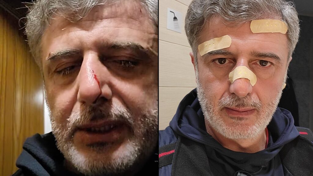 პროტესტის მონაწილის თქმით, სადარბაზოსთან ნიღბიანები თავს დაესხნენ